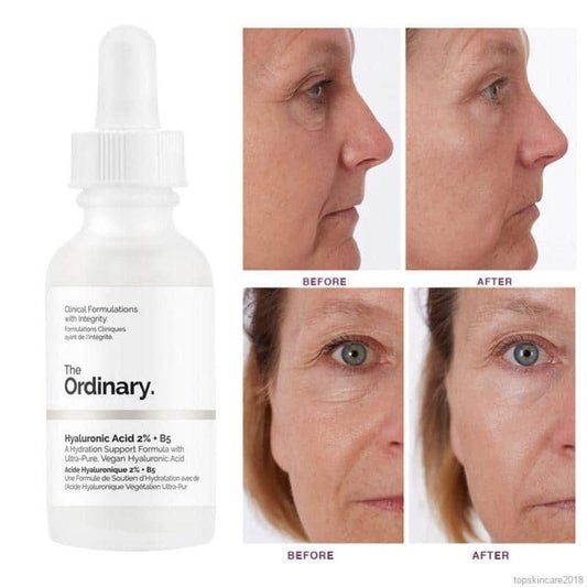 THE ORDINARY HYALURONIC ACID 2% + B5 30ML